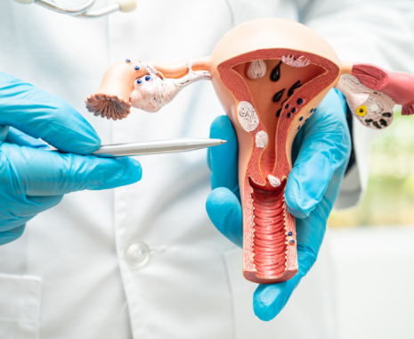 2024 年 1 月 – 子宮頸癌檢查講座